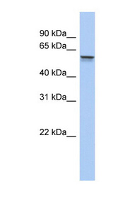 ALDH6A1 Antibody - ALDH6A1 antibody western blot of Fetal Kidney lysate.  This image was taken for the unconjugated form of this product. Other forms have not been tested.