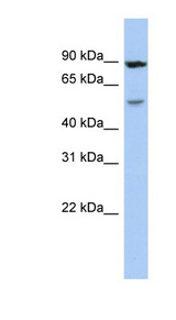 ALDH6A1 Antibody - ALDH6A1 antibody Western blot of THP-1 cell lysate. This image was taken for the unconjugated form of this product. Other forms have not been tested.