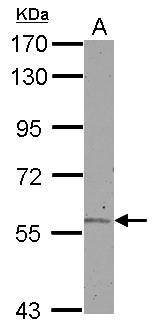 ALDH6A1 Antibody - Sample (30 ug of whole cell lysate) A: Jurkat 7.5% SDS PAGE ALDH6A1 antibody diluted at 1:1000