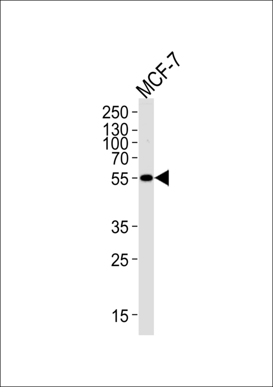 ALDH6A1 Antibody - ALDH6A1 Antibody western blot of MCF-7 cell lysate (35 ug/lane). This demonstrates that the ALDH6A1 antibody detected ALDH6A1 protein (arrow).