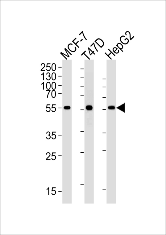 ALDH6A1 Antibody - ALDH6A1 Antibody western blot of MCF-7, T47D, HepG2 cell lysates (35 ug/lane). This demonstrates that the ALDH6A1 antibody detected ALDH6A1 protein (arrow).