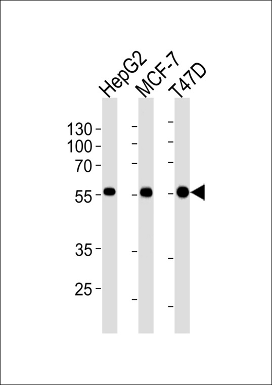 ALDH6A1 Antibody - ALDH6A1 Antibody western blot of HepG2, MCF-7,T47D cell line lysates (35 ug/lane). The ALDH6A1 antibody detected the ALDH6A1 protein (arrow).