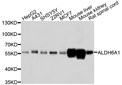 ALDH6A1 Antibody - Western blot analysis of extracts of various cells.