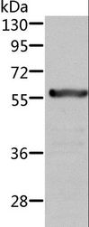 ALDH6A1 Antibody - Western blot analysis of Rat kidney tissue, using ALDH6A1 Polyclonal Antibody at dilution of 1:450.
