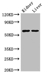 ALDH6A1 Antibody - Positive WB detected in:Mouse kidney tissue,Mouse liver tissue;All lanes:ALDH6A1 antibody at 2.5ug/ml;Secondary;Goat polyclonal to rabbit IgG at 1/50000 dilution;Predicted band size: 58,57 kDa;Observed band size: 58 kDa;