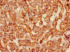 ALDH6A1 Antibody - Immunohistochemistry of paraffin-embedded human liver tissue using ALDH6A1 Antibody at dilution of 1:100