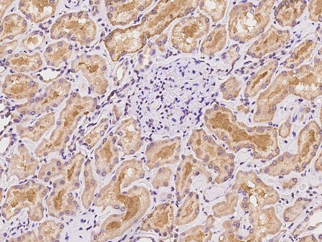 ALDH6A1 Antibody - Immunochemical staining of human ALDH6A1 in human kidney with rabbit polyclonal antibody at 1:100 dilution, formalin-fixed paraffin embedded sections.