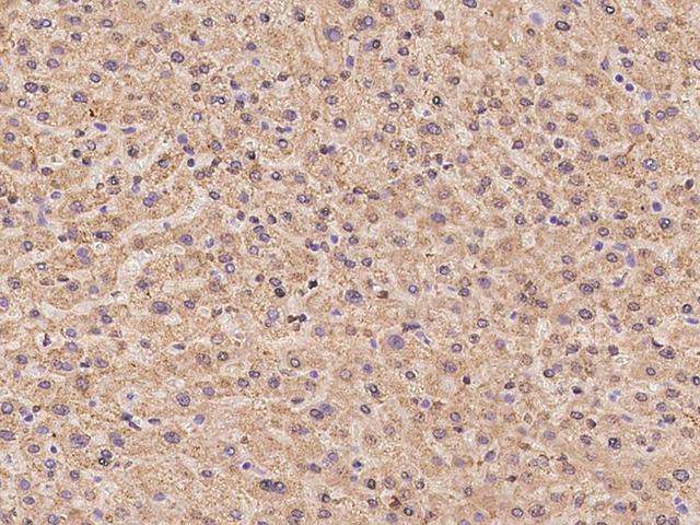ALDH6A1 Antibody - Immunochemical staining of human ALDH6A1 in human liver with rabbit polyclonal antibody at 1:100 dilution, formalin-fixed paraffin embedded sections.
