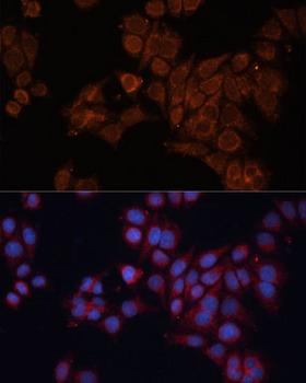 ALDH6A1 Antibody - Immunofluorescence analysis of HeLa cells using ALDH6A1 Polyclonal Antibody at dilution of 1:100 (40x lens).Blue: DAPI for nuclear staining.