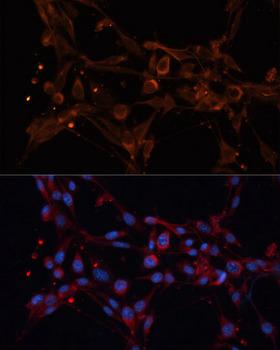 ALDH6A1 Antibody - Immunofluorescence analysis of NIH/3T3 cells using ALDH6A1 Polyclonal Antibody at dilution of 1:100 (40x lens).Blue: DAPI for nuclear staining.