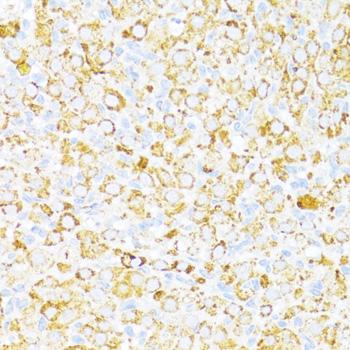 ALDH6A1 Antibody - Immunohistochemistry of paraffin-embedded Rat ovary using ALDH6A1 Polyclonal Antibody at dilution of 1:100 (40x lens).
