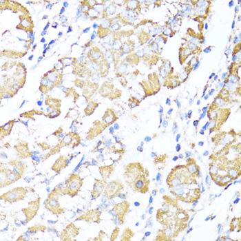 ALDH6A1 Antibody - Immunohistochemistry of paraffin-embedded Human stomach using ALDH6A1 Polyclonal Antibody at dilution of 1:100 (40x lens).