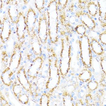 ALDH6A1 Antibody - Immunohistochemistry of paraffin-embedded Mouse kidney using ALDH6A1 Polyclonal Antibody at dilution of 1:100 (40x lens).