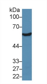 ALDH7A1 Antibody - Western Blot; Sample: Rat Liver lysate; Primary Ab: 5µg/ml Rabbit Anti-Human ALDH7A1 Antibody Second Ab: 0.2µg/mL HRP-Linked Caprine Anti-Rabbit IgG Polyclonal Antibody