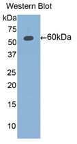 ALDH7A1 Antibody - Western Blot; Sample: Recombinant protein.