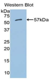 ALDH7A1 Antibody - Western blot of recombinant ALDH7A1.  This image was taken for the unconjugated form of this product. Other forms have not been tested.