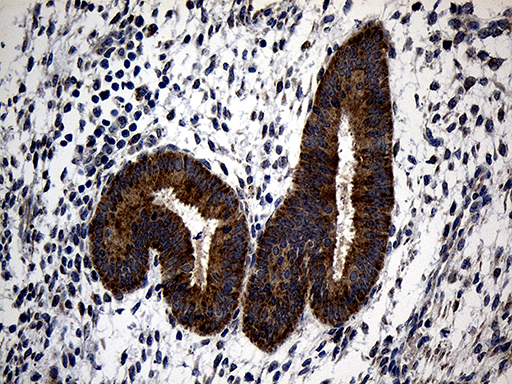 ALDH7A1 Antibody - Immunohistochemical staining of paraffin-embedded Human endometrium tissue within the normal limits using anti-ALDH7A1 mouse monoclonal antibody. (Heat-induced epitope retrieval by 1mM EDTA in 10mM Tris buffer. (pH8.5) at 120°C for 3 min. (1:500)