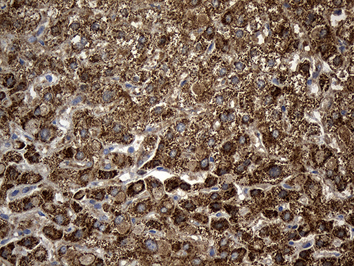 ALDH7A1 Antibody - Immunohistochemical staining of paraffin-embedded Human liver tissue within the normal limits using anti-ALDH7A1 mouse monoclonal antibody. (Heat-induced epitope retrieval by 1mM EDTA in 10mM Tris buffer. (pH8.5) at 120°C for 3 min. (1:500)