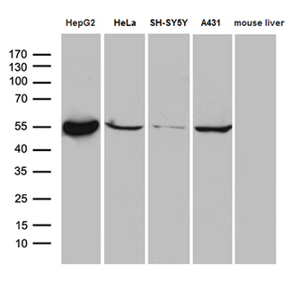 ALDH7A1 Antibody - Western blot analysis of extracts. (35ug) from 4 different cell lines and mouse liver tissue lysate by using anti-ALDH7A1 monoclonal antibody. (1:500)