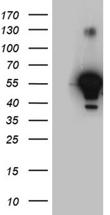 ALDH7A1 Antibody - HEK293T cells were transfected with the pCMV6-ENTRY control. (Left lane) or pCMV6-ENTRY ALDH7A1. (Right lane) cDNA for 48 hrs and lysed. Equivalent amounts of cell lysates. (5 ug per lane) were separated by SDS-PAGE and immunoblotted with anti-ALDH7A1. (1:2000)