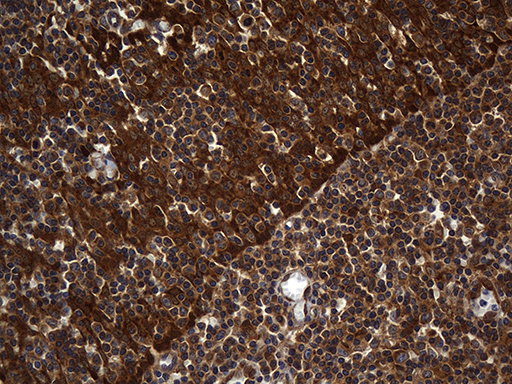 ALDH7A1 Antibody - Immunohistochemical staining of paraffin-embedded Human tonsil within the normal limits using anti-ALDH7A1 mouse monoclonal antibody. (Heat-induced epitope retrieval by 1mM EDTA in 10mM Tris buffer. (pH8.5) at 120°C for 3 min. (1:2000)