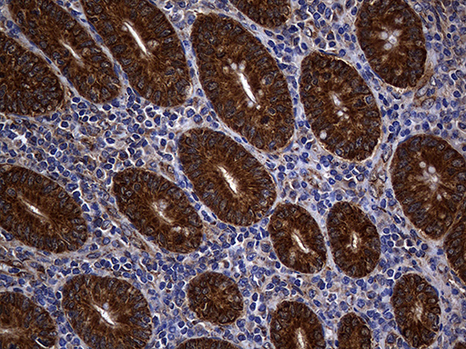 ALDH7A1 Antibody - Immunohistochemical staining of paraffin-embedded Human appendix tissue within the normal limits using anti-ALDH7A1 mouse monoclonal antibody. (Heat-induced epitope retrieval by Tris-EDTA(1:2000)