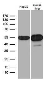 ALDH7A1 Antibody - Western blot analysis of extracts. (35ug) from HepG2 cell line and mouse liver tissue lysate by using anti-ALDH7A1 monoclonal antibody. (1:500)