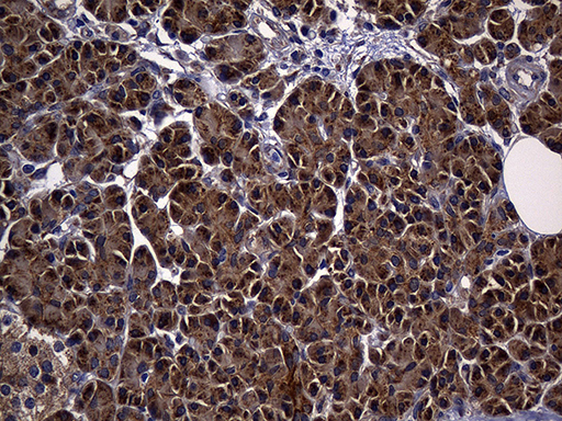 ALDH7A1 Antibody - Immunohistochemical staining of paraffin-embedded Human pancreas tissue within the normal limits using anti-ALDH7A1 mouse monoclonal antibody. (Heat-induced epitope retrieval by 1mM EDTA in 10mM Tris buffer. (pH8.5) at 120°C for 3 min. (1:2000)