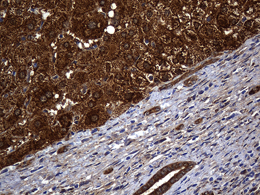 ALDH7A1 Antibody - Immunohistochemical staining of paraffin-embedded Human liver tissue within the normal limits using anti-ALDH7A1 mouse monoclonal antibody. (Heat-induced epitope retrieval by 1mM EDTA in 10mM Tris buffer. (pH8.5) at 120°C for 3 min. (1:2000)