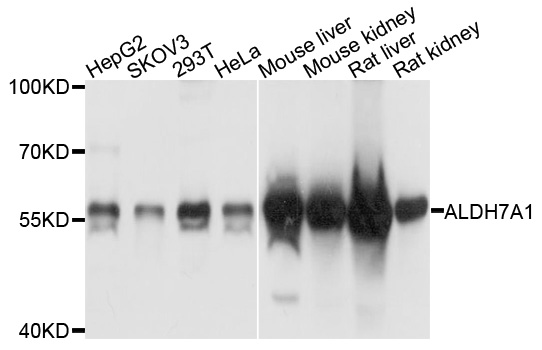 ALDH7A1 Antibody - Western blot analysis of extracts of various cells.