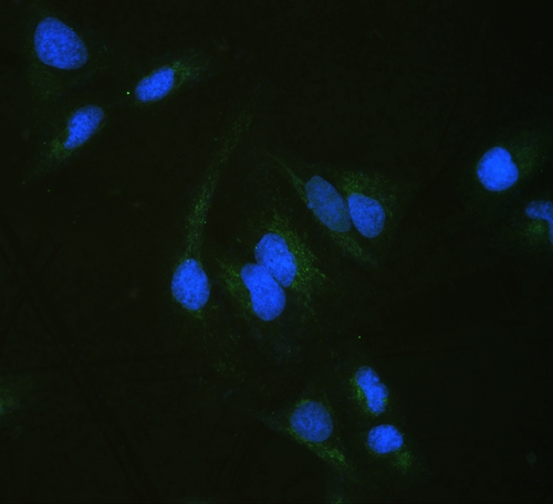 ALDH7A1 Antibody - IF analysis of ALDH7A1 using anti-ALDH7A1 antibody ALDH7A1 was detected in immunocytochemical section of U20S cell. Enzyme antigen retrieval was performed using IHC enzyme antigen retrieval reagent for 15 mins. The tissue section was blocked with 10% goat serum. The tissue section was then incubated with 2µg/mL rabbit anti-ALDH7A1 Antibody overnight at 4°C. DyLight®488 Conjugated Goat Anti-Rabbit IgG was used as secondary antibody at 1:100 dilution and incubated for 30 minutes at 37°C. The section was counterstained with DAPI. Visualize using a fluorescence microscope and filter sets appropriate for the label used.