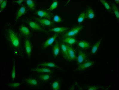 ALDH7A1 Antibody - Immunofluorescence staining of Hela cells at a dilution of 1:133, counter-stained with DAPI. The cells were fixed in 4% formaldehyde, permeabilized using 0.2% Triton X-100 and blocked in 10% normal Goat Serum. The cells were then incubated with the antibody overnight at 4 °C.The secondary antibody was Alexa Fluor 488-congugated AffiniPure Goat Anti-Rabbit IgG (H+L) .