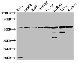 ALDH7A1 Antibody - Positive Western Blot detected in Hela whole cell lysate, HepG2 whole cell lysate, 293T whole cell lysate, SH-SY5Y whole cell lysate, Rat liver tissue, Rat kidney tissue, Mouse liver tissue, Mouse kidney tissue. All lanes: ALDH7A1 antibody at 4.7 µg/ml Secondary Goat polyclonal to rabbit IgG at 1/50000 dilution. Predicted band size: 59, 56, 52 KDa. Observed band size: 59 KDa