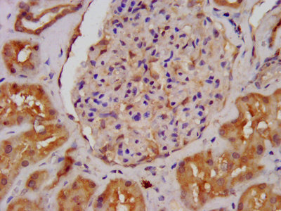 ALDH7A1 Antibody - IHC image of ALDH7A1 Antibody diluted at 1:400 and staining in paraffin-embedded human kidney tissue performed on a Leica BondTM system. After dewaxing and hydration, antigen retrieval was mediated by high pressure in a citrate buffer (pH 6.0). Section was blocked with 10% normal goat serum 30min at RT. Then primary antibody (1% BSA) was incubated at 4°C overnight. The primary is detected by a biotinylated secondary antibody and visualized using an HRP conjugated SP system.
