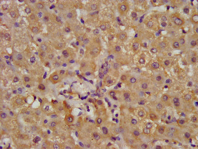 ALDH7A1 Antibody - IHC image of ALDH7A1 Antibody diluted at 1:400 and staining in paraffin-embedded human liver tissue performed on a Leica BondTM system. After dewaxing and hydration, antigen retrieval was mediated by high pressure in a citrate buffer (pH 6.0). Section was blocked with 10% normal goat serum 30min at RT. Then primary antibody (1% BSA) was incubated at 4°C overnight. The primary is detected by a biotinylated secondary antibody and visualized using an HRP conjugated SP system.