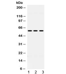 ALDH7A1 Antibody - Western blot testing of 1) rat liver, 2) mouse HEPA and 3) human HeLa lysate with ALDH7A1 antibody at 0.5ug/ml. Predicted molecular weight ~58 kDa.