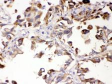 ALDH7A1 Antibody - IHC testing of FFPE human lung with ALDH7A1 antibody at 1ug/ml. HIER: steam sections in pH6 citrate buffer for 20 min.