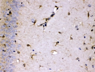 ALDH7A1 Antibody - IHC testing of FFPE rat brain with ALDH7A1 antibody at 1ug/ml. HIER: steam sections in pH6 citrate buffer for 20 min.