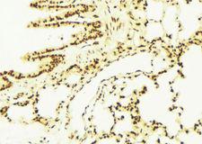 ALDH7A1 Antibody - 1:100 staining mouse lung tissue by IHC-P. The sample was formaldehyde fixed and a heat mediated antigen retrieval step in citrate buffer was performed. The sample was then blocked and incubated with the antibody for 1.5 hours at 22°C. An HRP conjugated goat anti-rabbit antibody was used as the secondary.