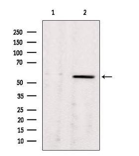ALDH7A1 Antibody - Western blot analysis of extracts of rat brain tissue using ALDH7A1 antibody. Lane 1 was treated with the blocking peptide.