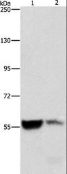 ALDH8A1 Antibody - Western blot analysis of Mouse liver and kidney tissue, using ALDH8A1 Polyclonal Antibody at dilution of 1:550.
