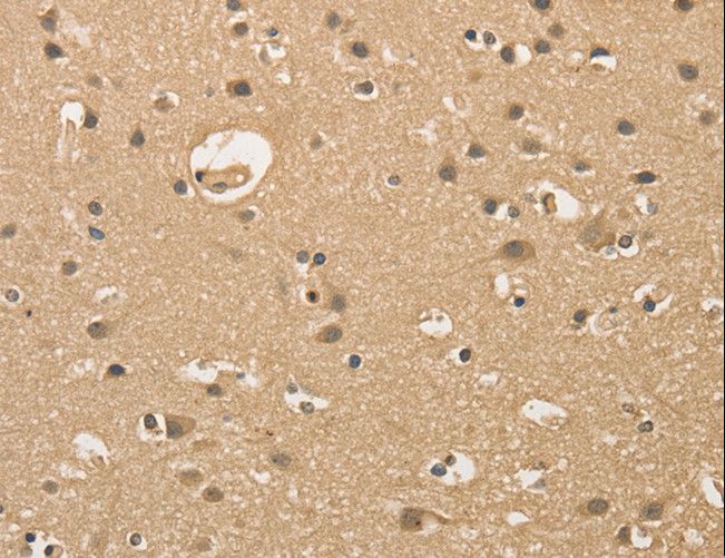 ALDH8A1 Antibody - Immunohistochemistry of paraffin-embedded Human brain using ALDH8A1 Polyclonal Antibody at dilution of 1:30.
