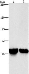 ALDH8A1 Antibody - Western blot analysis of Mouse liver and kidney tissue, using ALDH8A1 Polyclonal Antibody at dilution of 1:800.