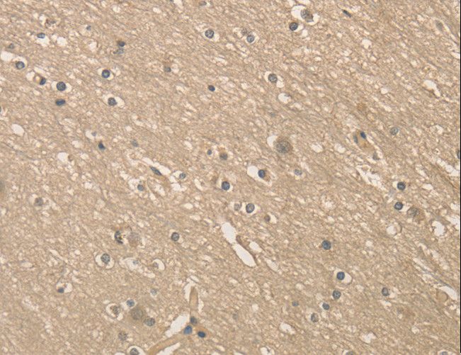 ALDH8A1 Antibody - Immunohistochemistry of paraffin-embedded Human brain using ALDH8A1 Polyclonal Antibody at dilution of 1:40.
