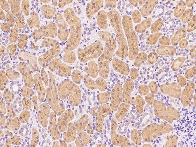 ALDH8A1 Antibody - Immunochemical staining of human ALDH8A1 in human kidney with rabbit polyclonal antibody at 1:1000 dilution, formalin-fixed paraffin embedded sections.