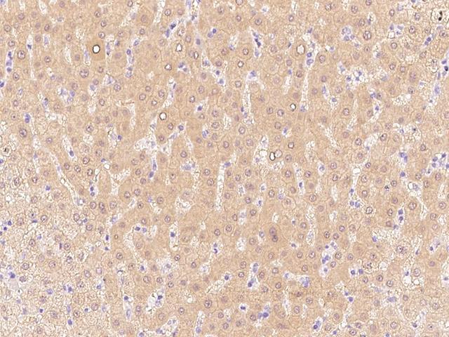 ALDH8A1 Antibody - Immunochemical staining of human ALDH8A1 in human liver with rabbit polyclonal antibody at 1:1000 dilution, formalin-fixed paraffin embedded sections.