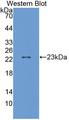 ALDH9A1 Antibody - Western blot of ALDH9A1 antibody.