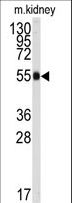 ALDH9A1 Antibody - Western blot of anti-ALDH9A1 Antibody in mouse kidney tissue lysates (35 ug/lane). ALDH9A1(arrow) was detected using the purified antibody.
