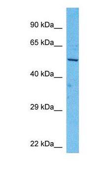 ALDH9A1 Antibody - Western blot of AL9A1 Antibody with human ACHN Whole Cell lysate.  This image was taken for the unconjugated form of this product. Other forms have not been tested.
