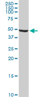 ALDH9A1 Antibody - ALDH9A1 monoclonal antibody (M01), clone 3C6. Western Blot analysis of ALDH9A1 expression in human liver.